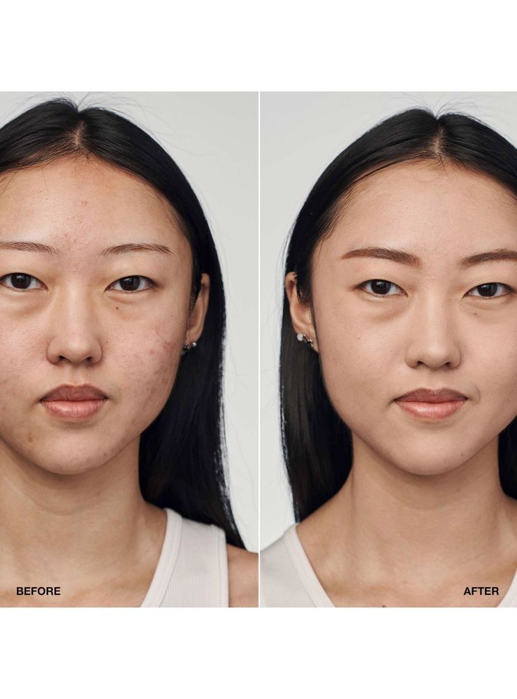 Clinique Even Better Clinical Serum Foundation SPF 20 CN 28 Ivory, foto 3