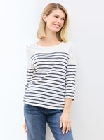 Polera Listada con Botones Decorativos