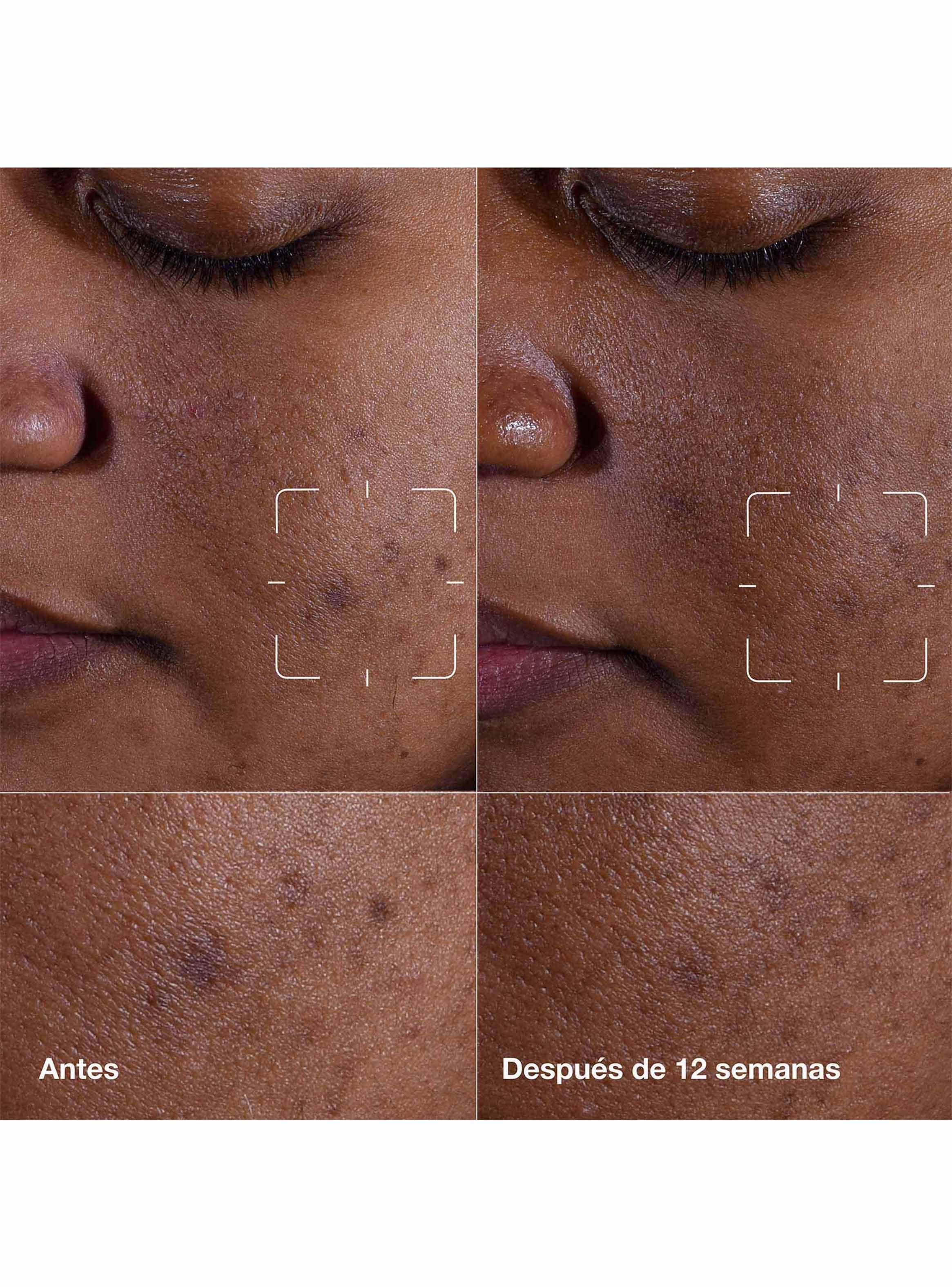 Suero Facial Even Better Clinical Dark Spot Clearing Serum 30 ml-4