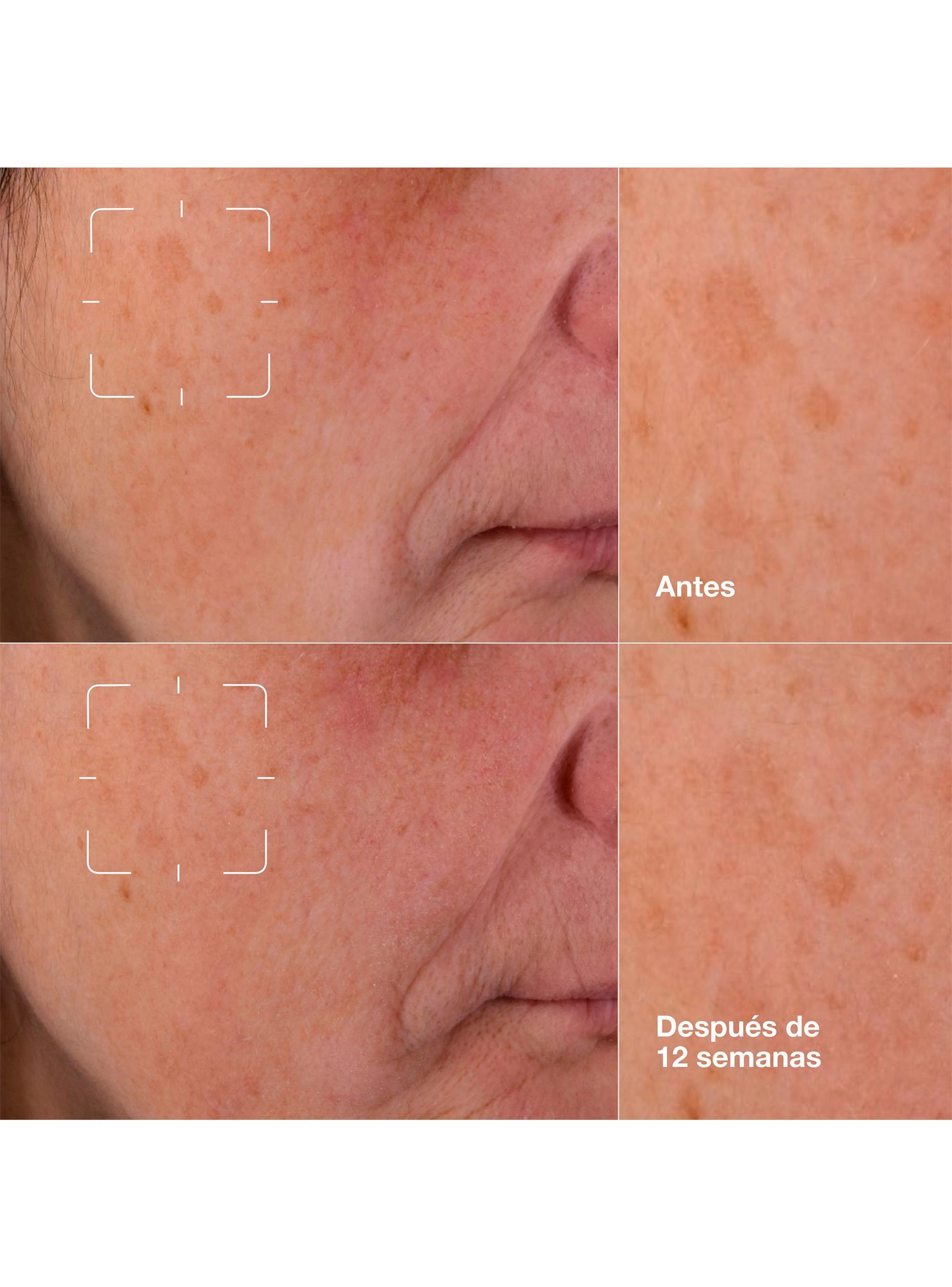 Suero Facial Even Better Clinical Dark Spot Clearing Serum 30 ml-5