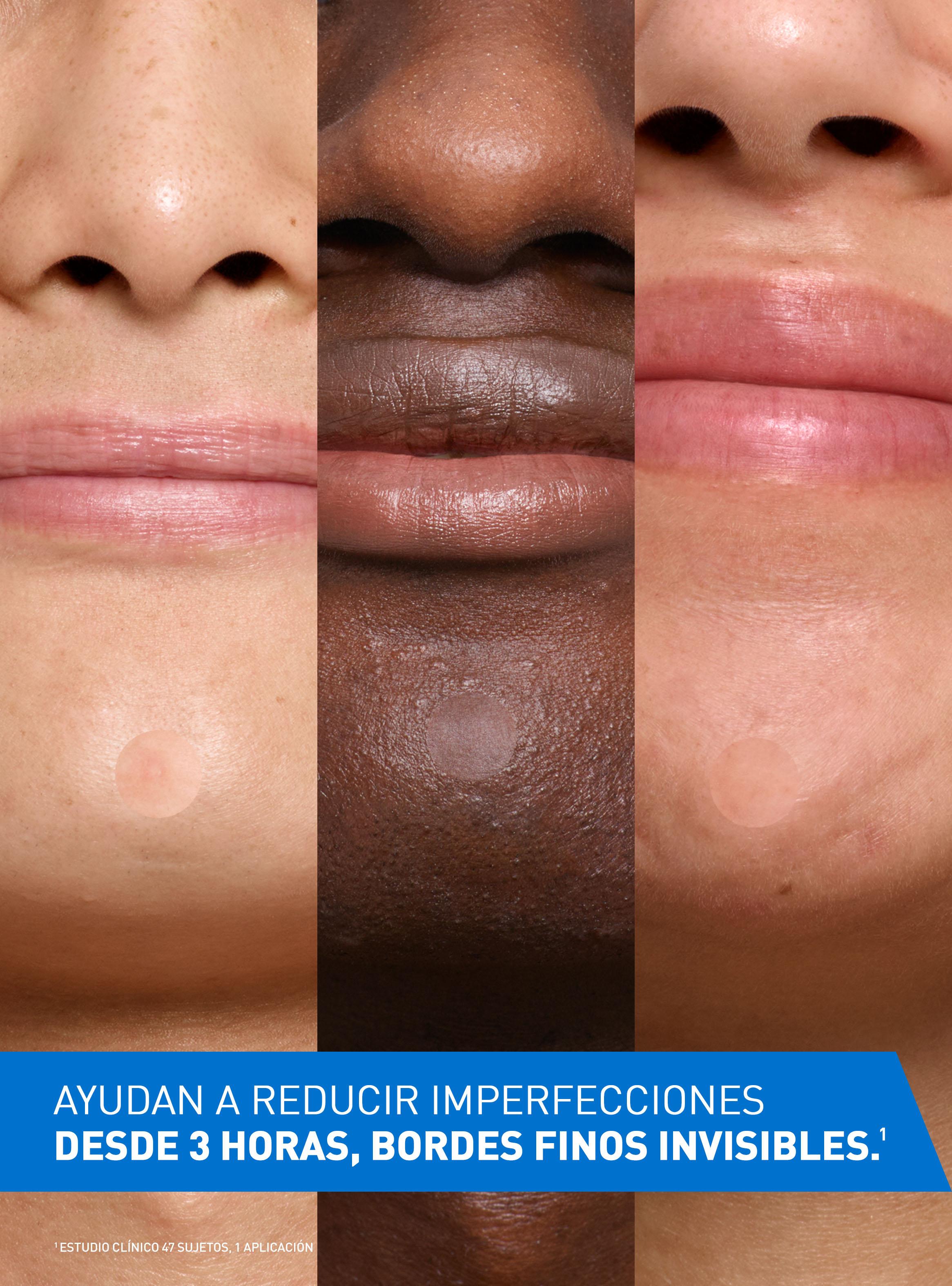 Parches Control Imperfecciones 22 Unidades-2