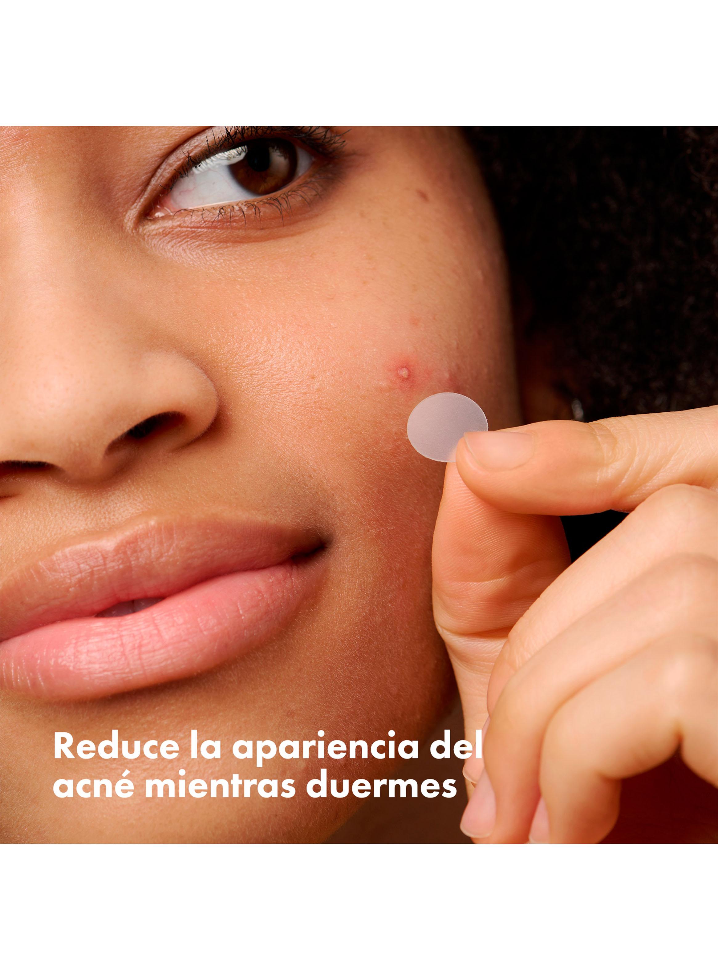 Parche Original 24U-3