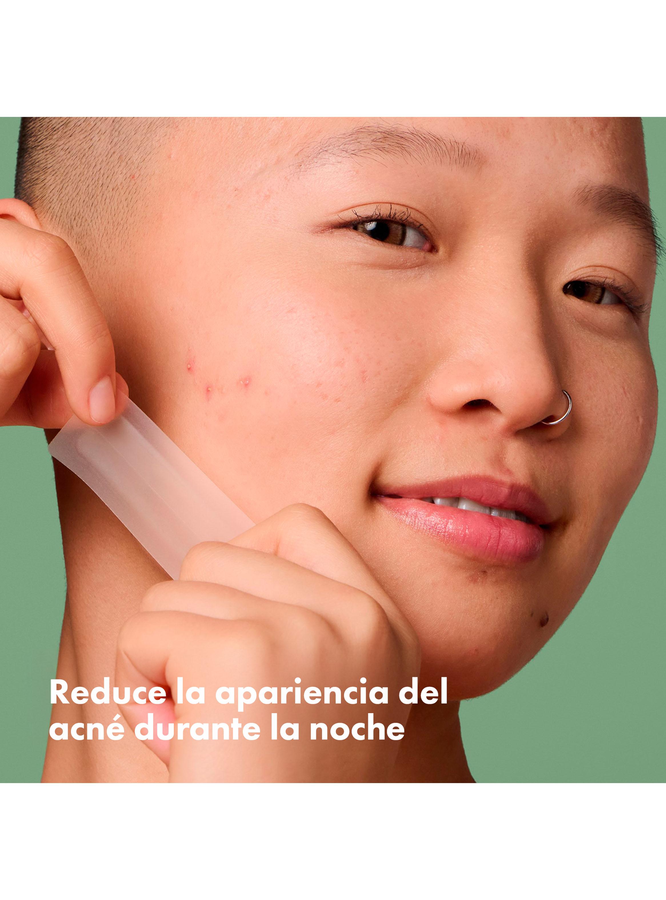 Parche Acné Surface 10U-3