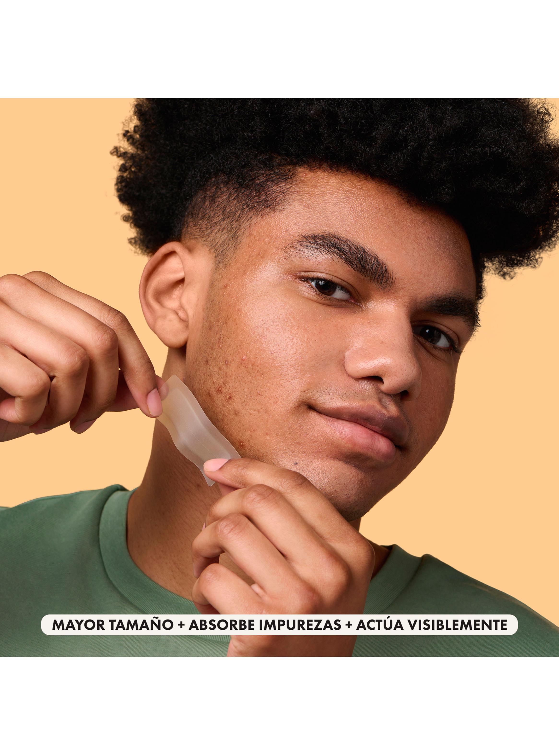 Parche Acné Surface 10U-5