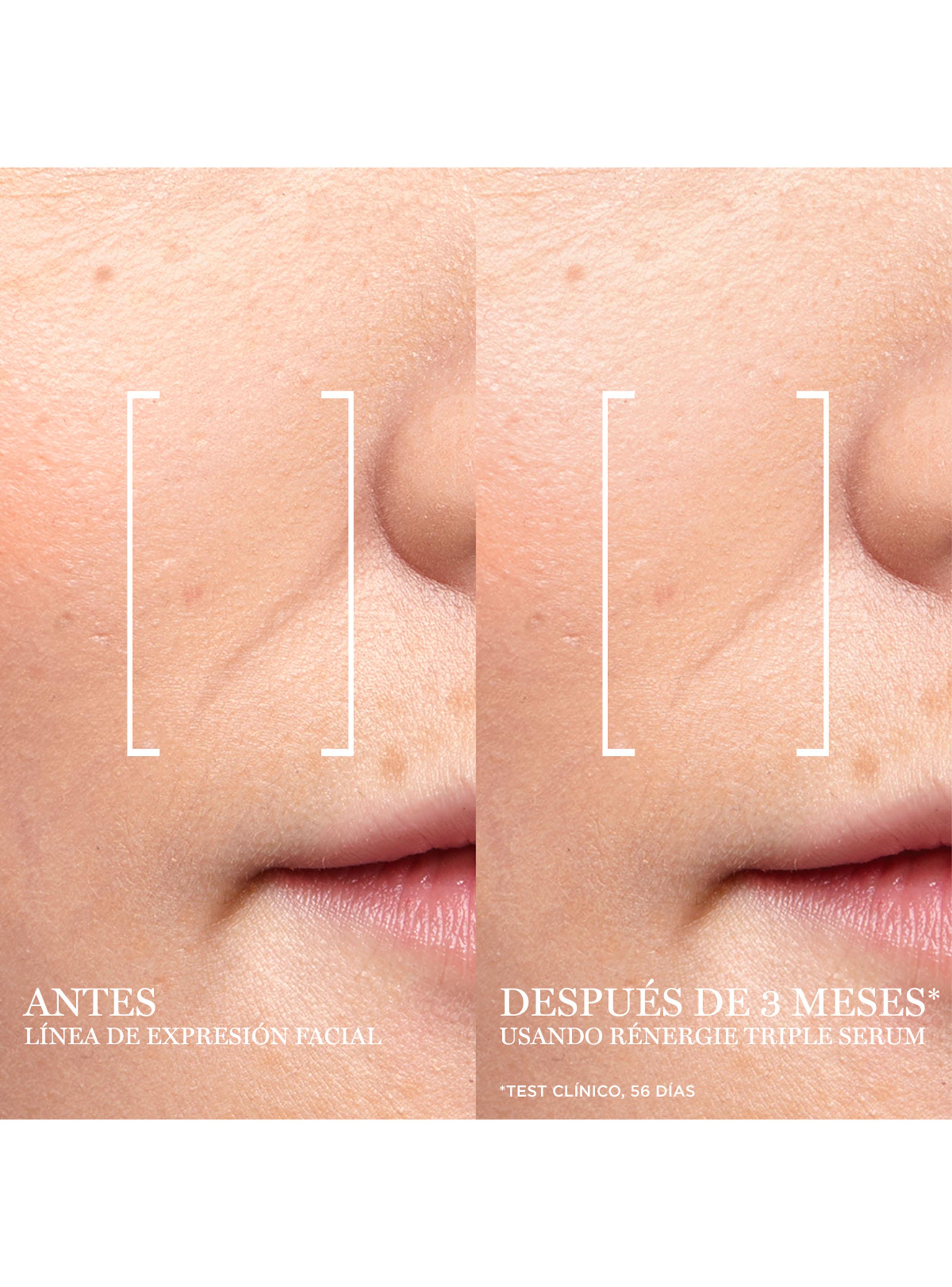 Set Rutina Antiedad Renérgie H.C.F. Triple Sérum 50 ml-4