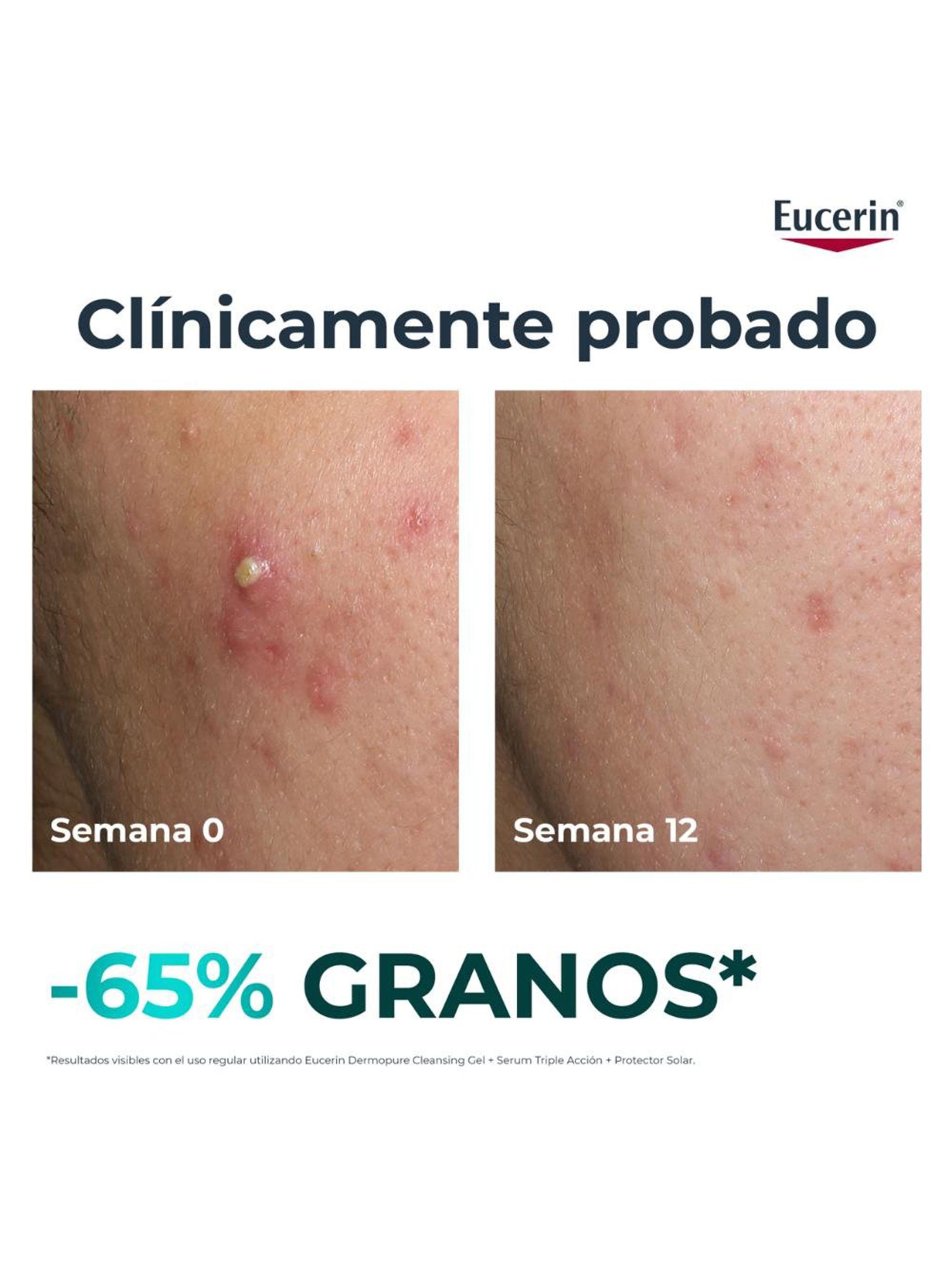 Eucerin Dermopure Triple Effect Serum 40 ml-3