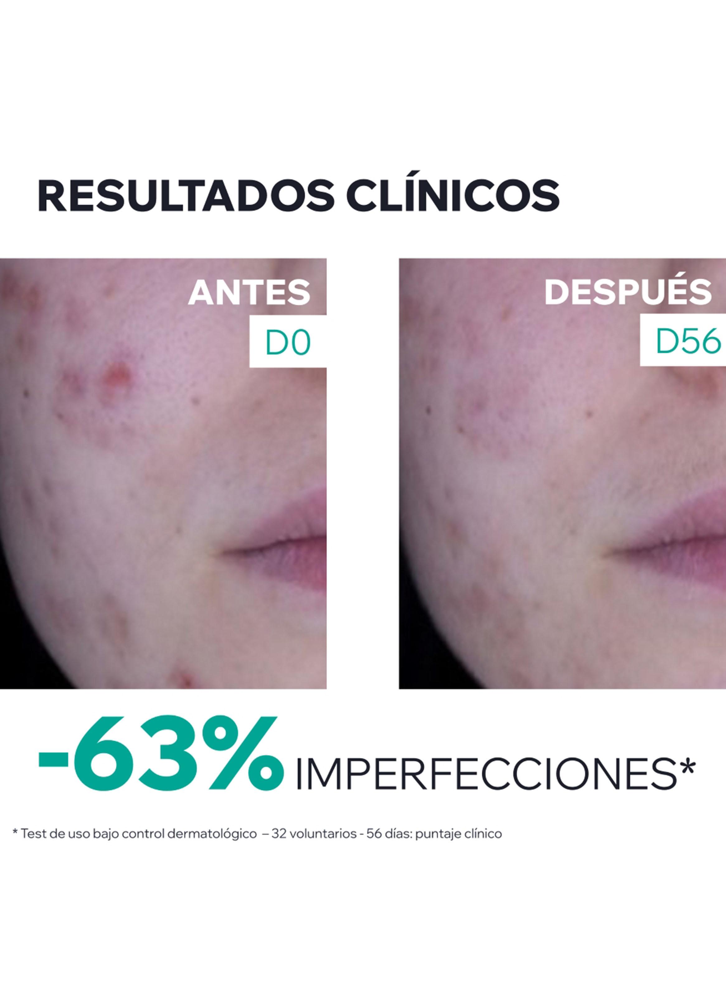 Crema Anti-Imperfecciones Hyséac 3-Regul+ 40 ml Uriage-5