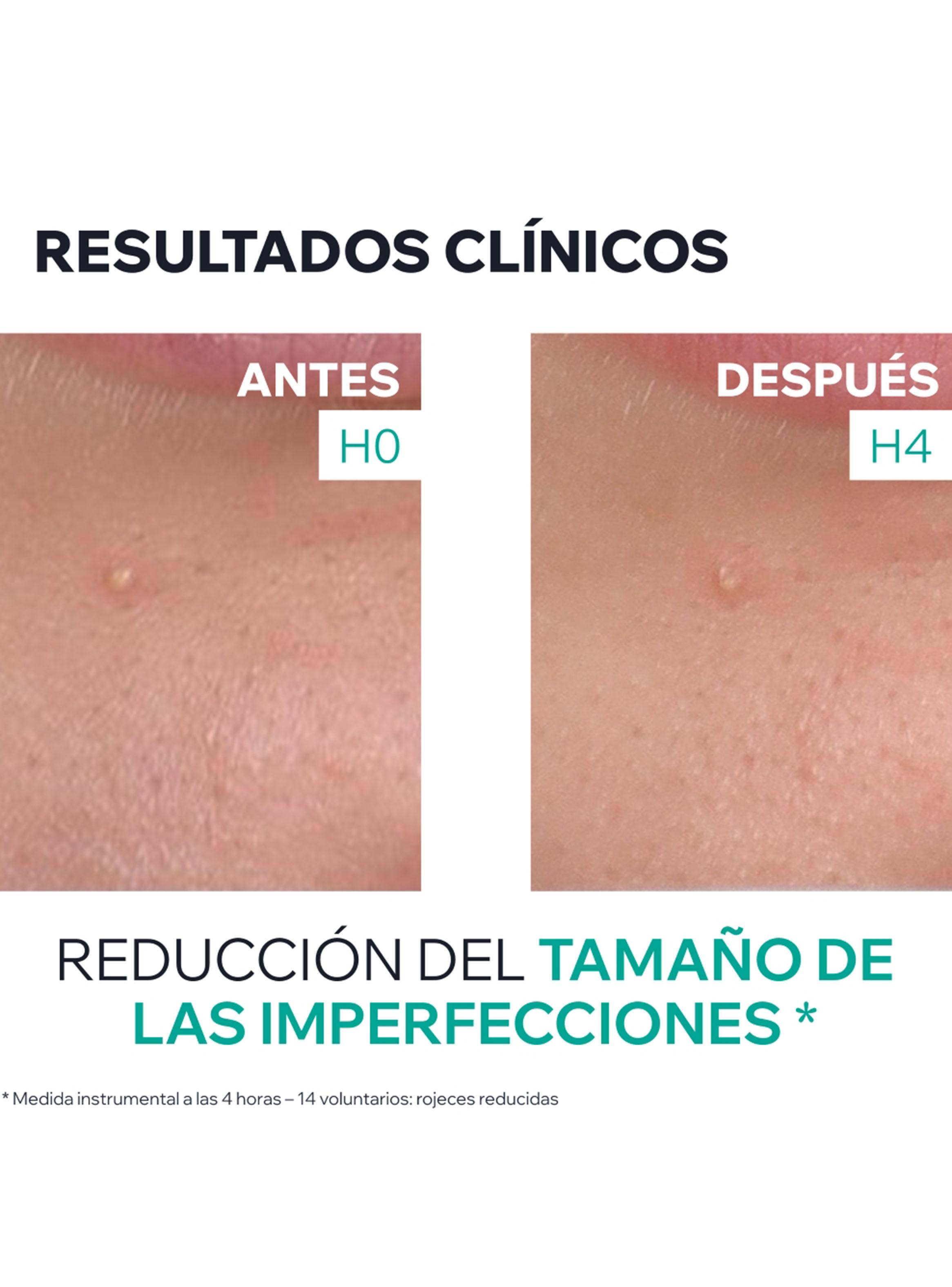 Gel Secante Imperfecciones Hyséac SOS 15 ml Uriage-5