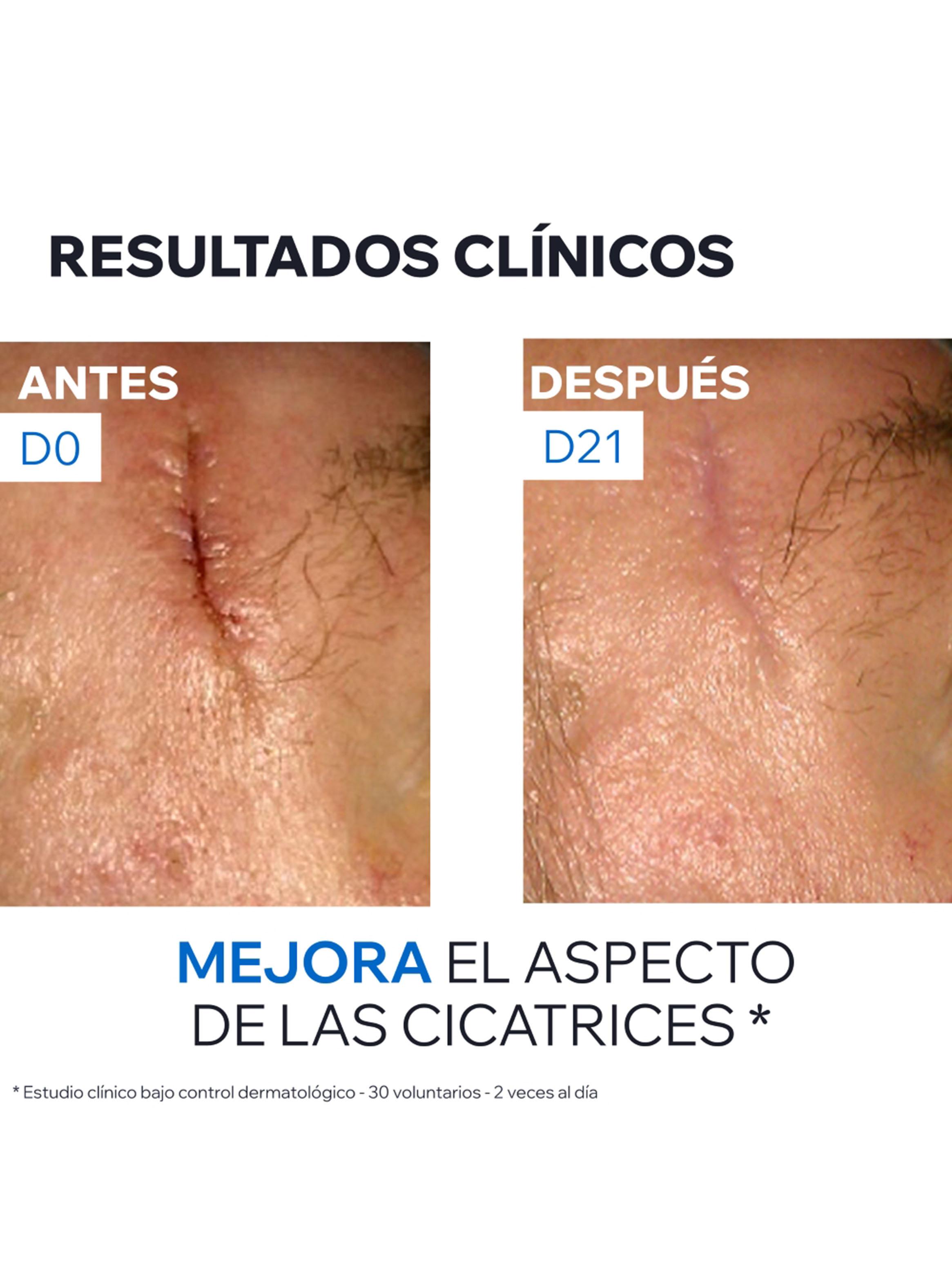Crema Reparadora con Cobre y Zinc Eau Thermale Uriage Bariéderm-CICA 40 ml-5