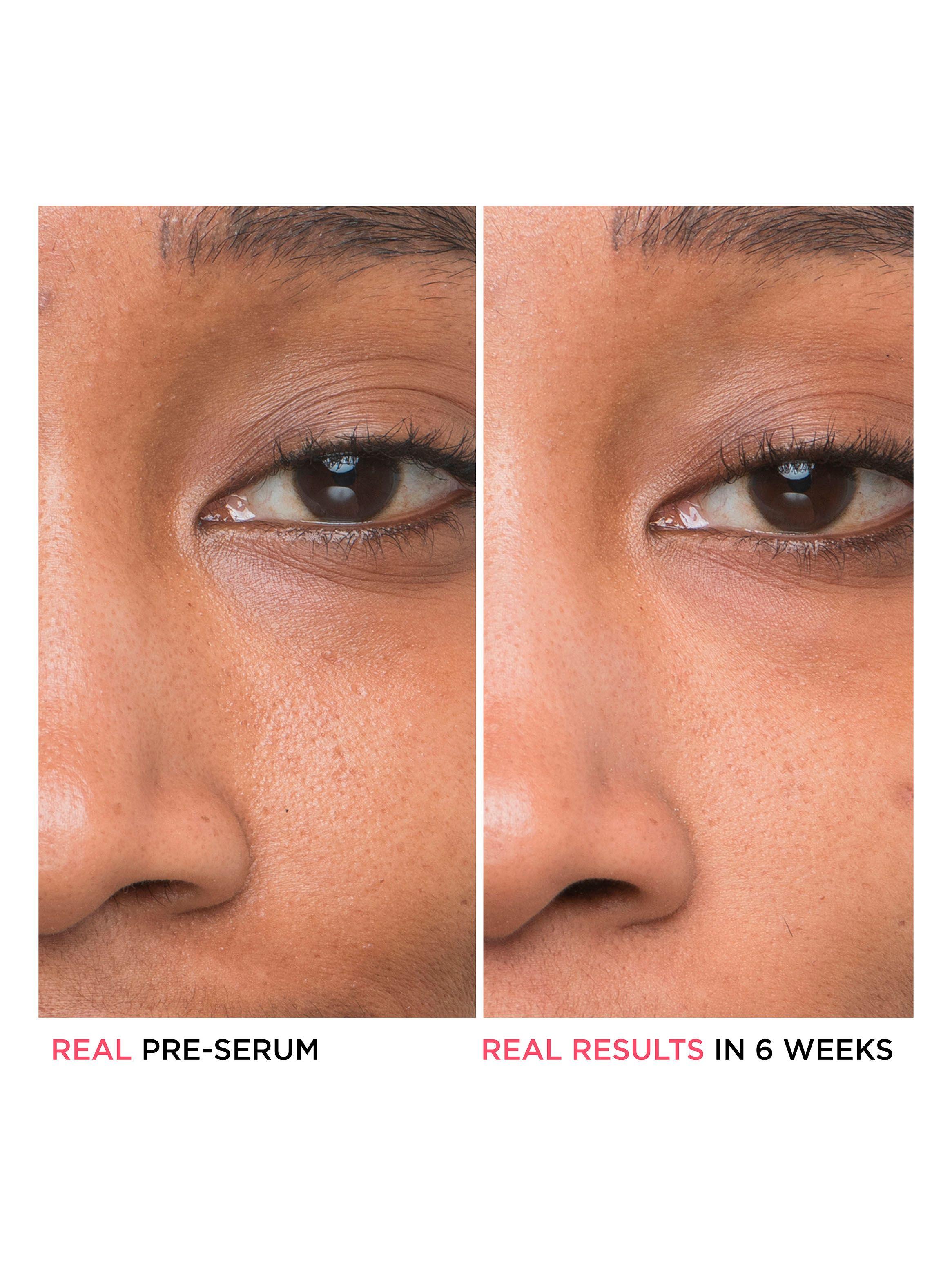Serums Rostro para Poros Bye Bye Pores 30 ml-3