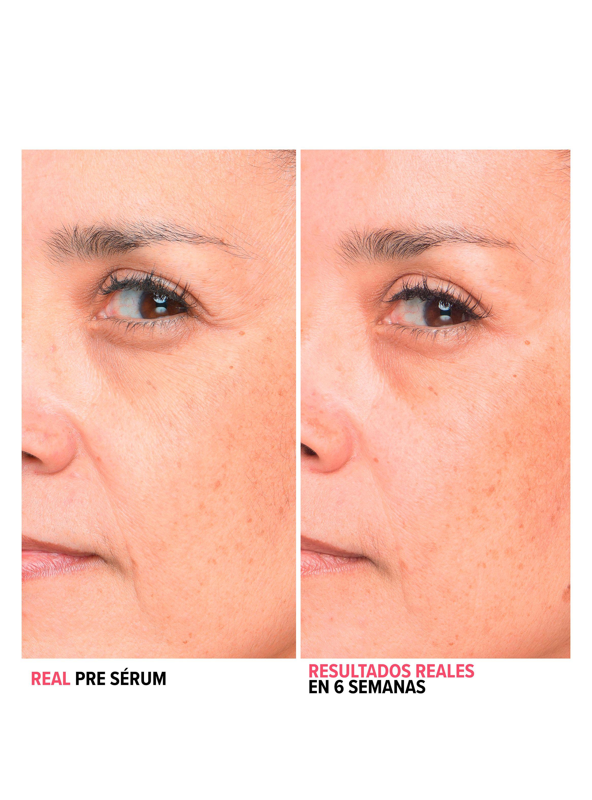Serums de Rostro para Lineas de Expresión de la Piel Bye Bye Lines 30 ml-4