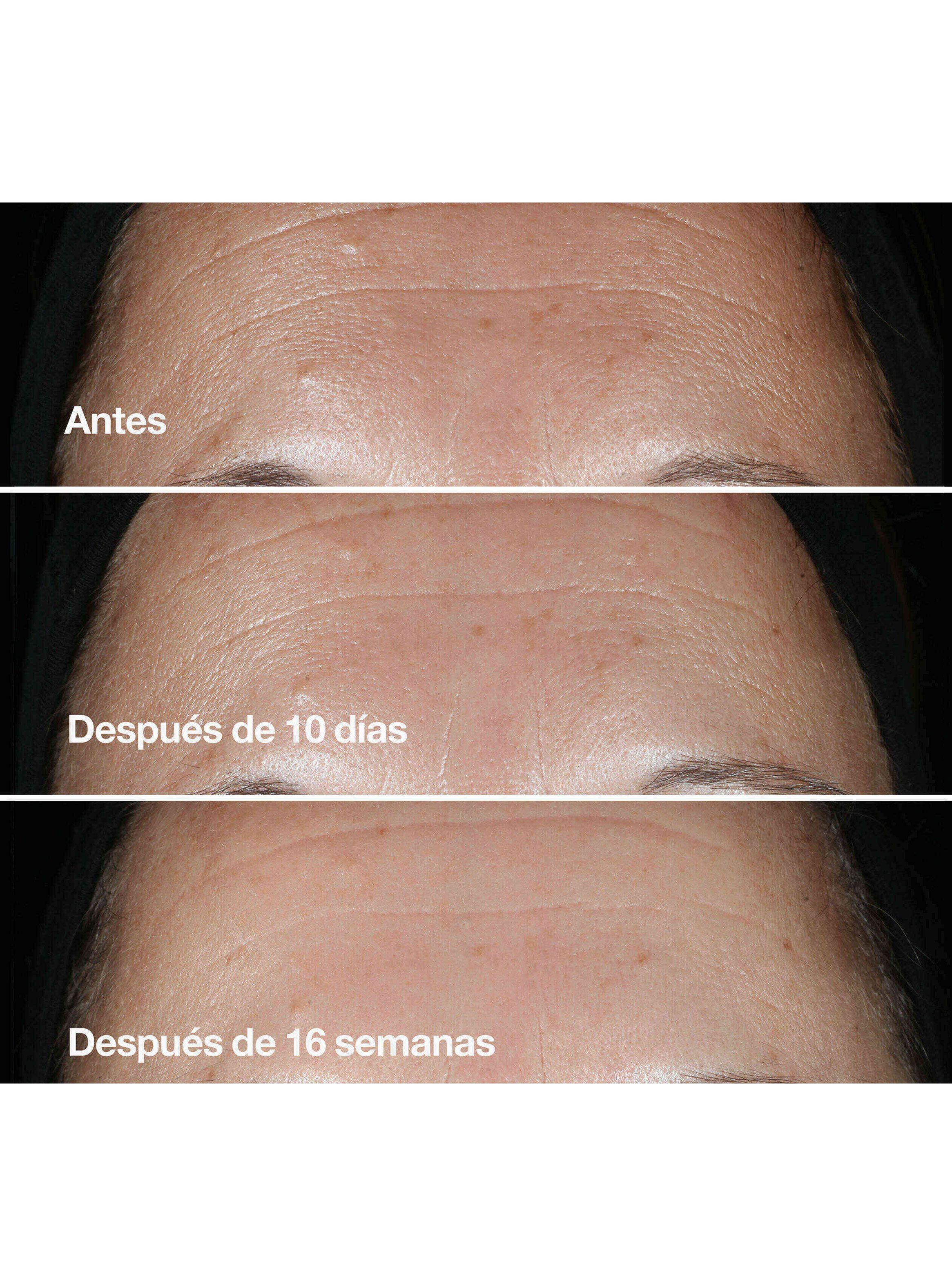 Suero Corrector de Arrugas Smart Clinical Repair 30 ml-4