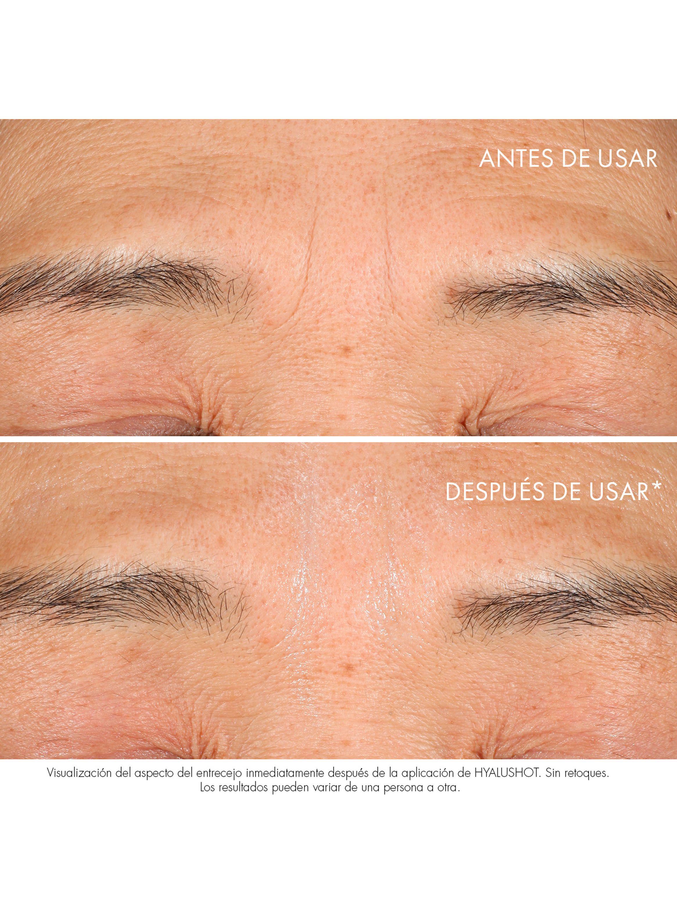 Corrector de Arrugar Dior Capture Totale Hyalushot-2