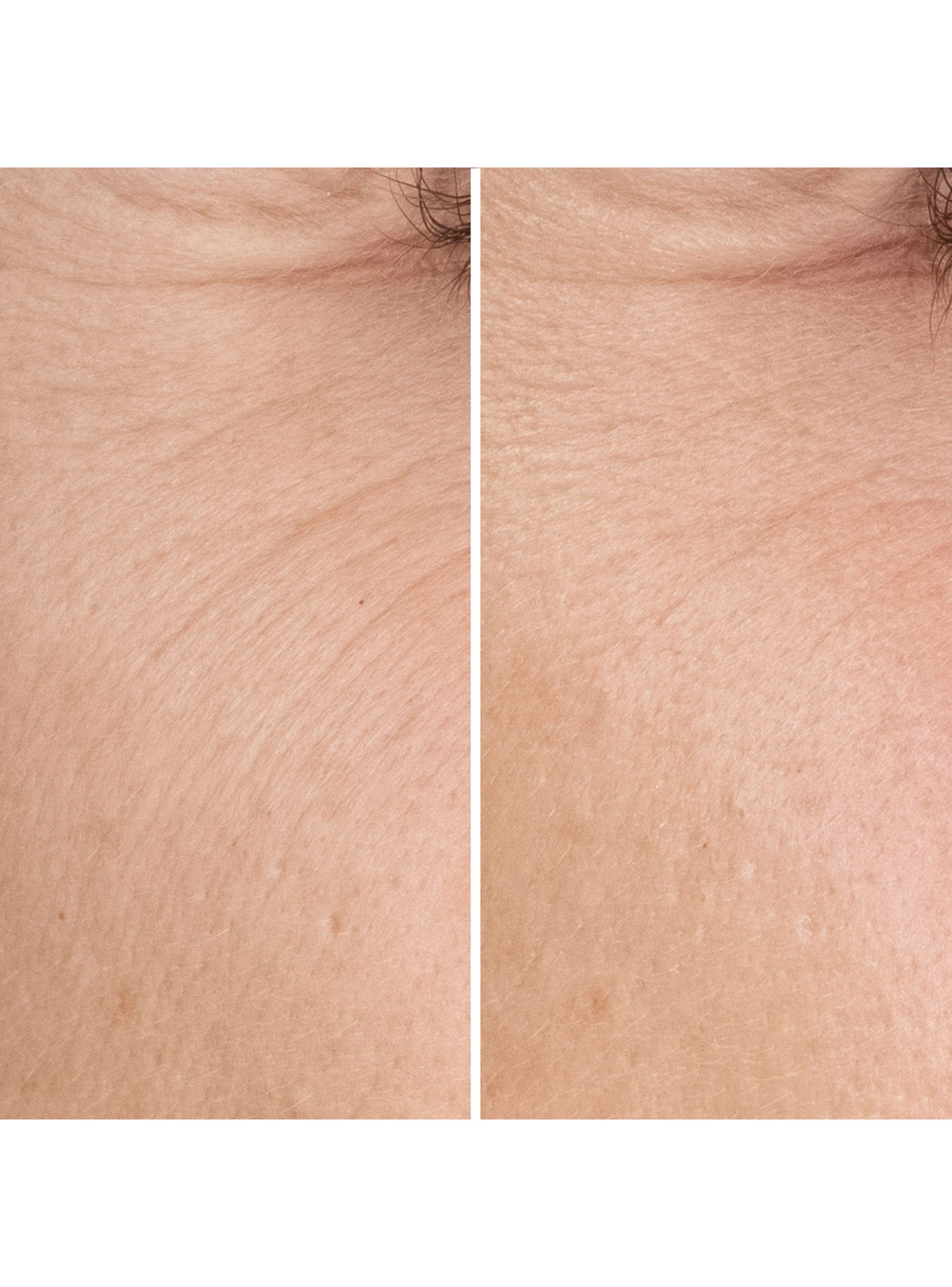 Crema Antiedad Blue Pro Retinol Multi Correct 30 ml Biotherm-2