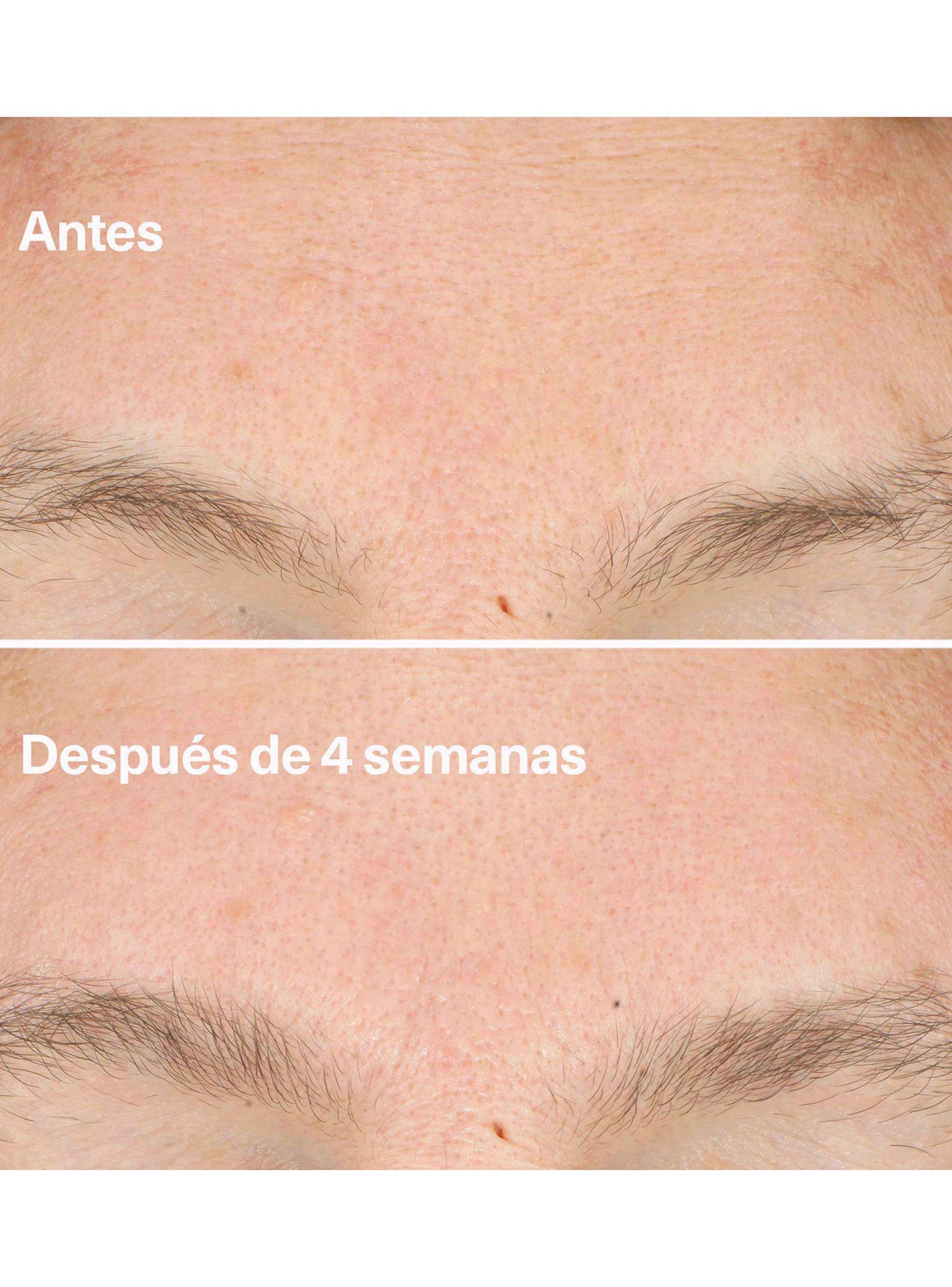 Crema Facial Clarifying Do-Over Peel-4