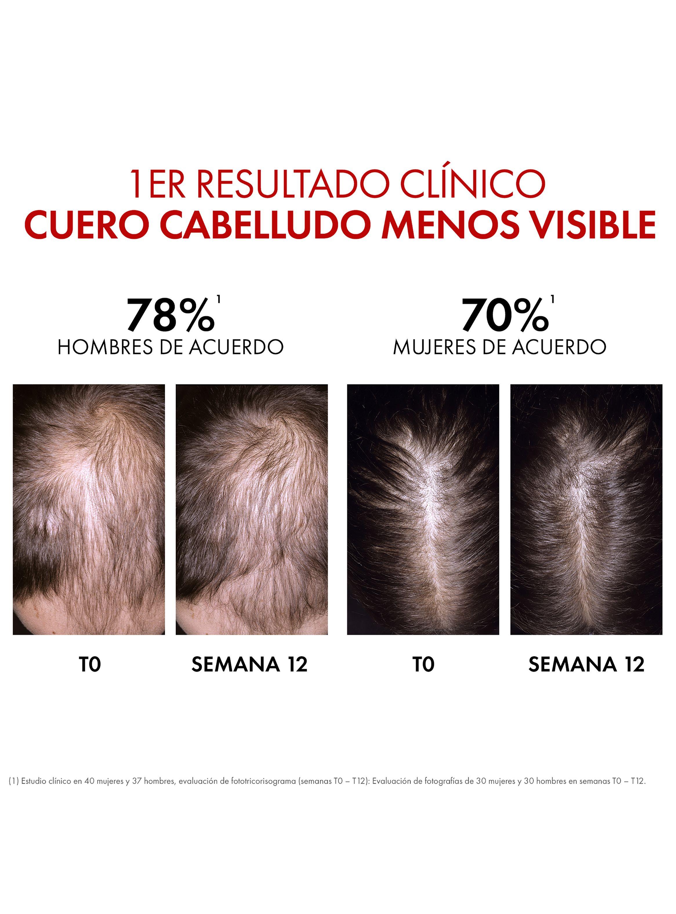 Dercos Serum Anti-Caída Aminexil Clinical Regen 90 ml-6