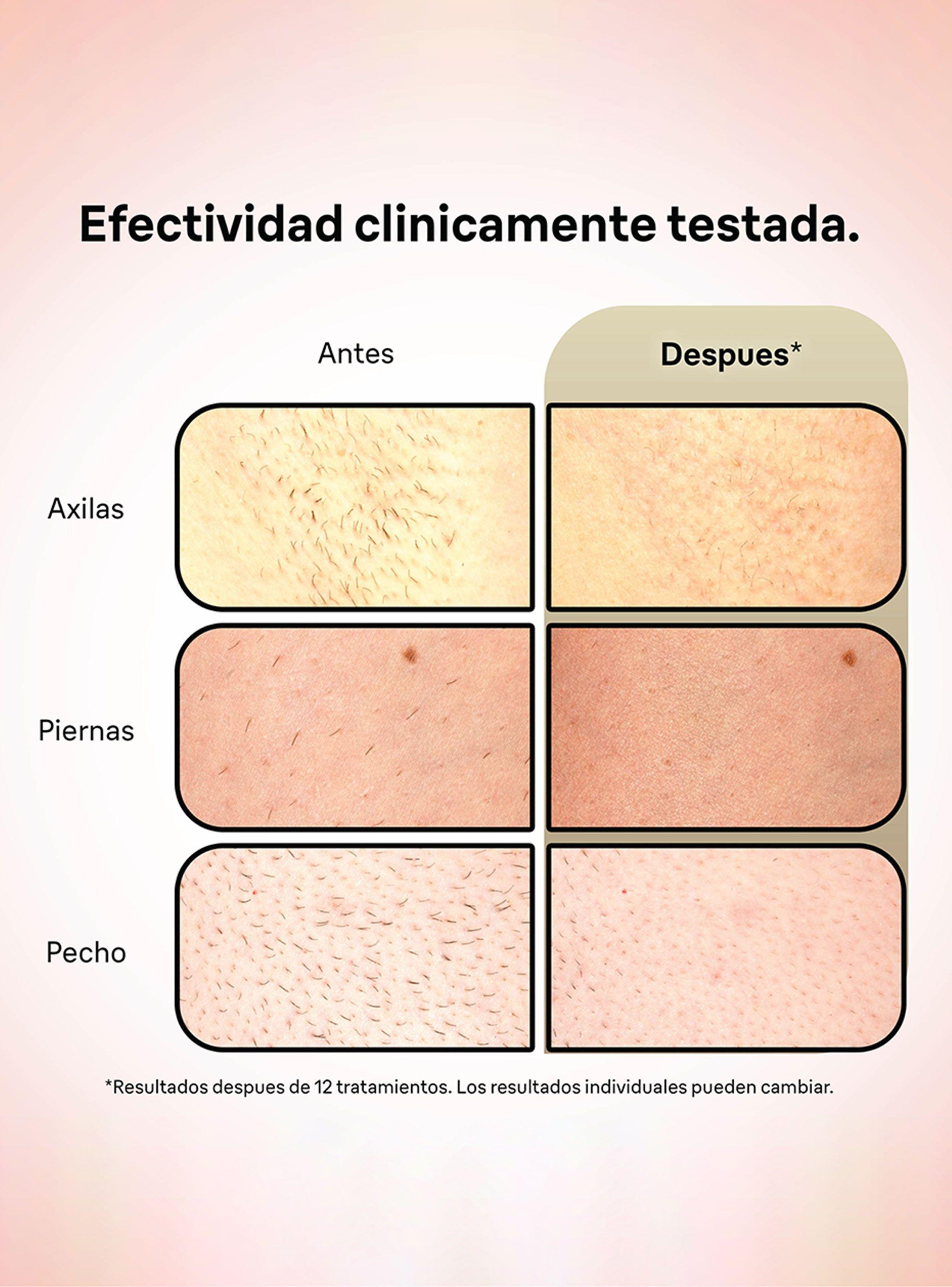 Depiladora IPL Silk-Expert Pro 5 Corporal y Facial-5