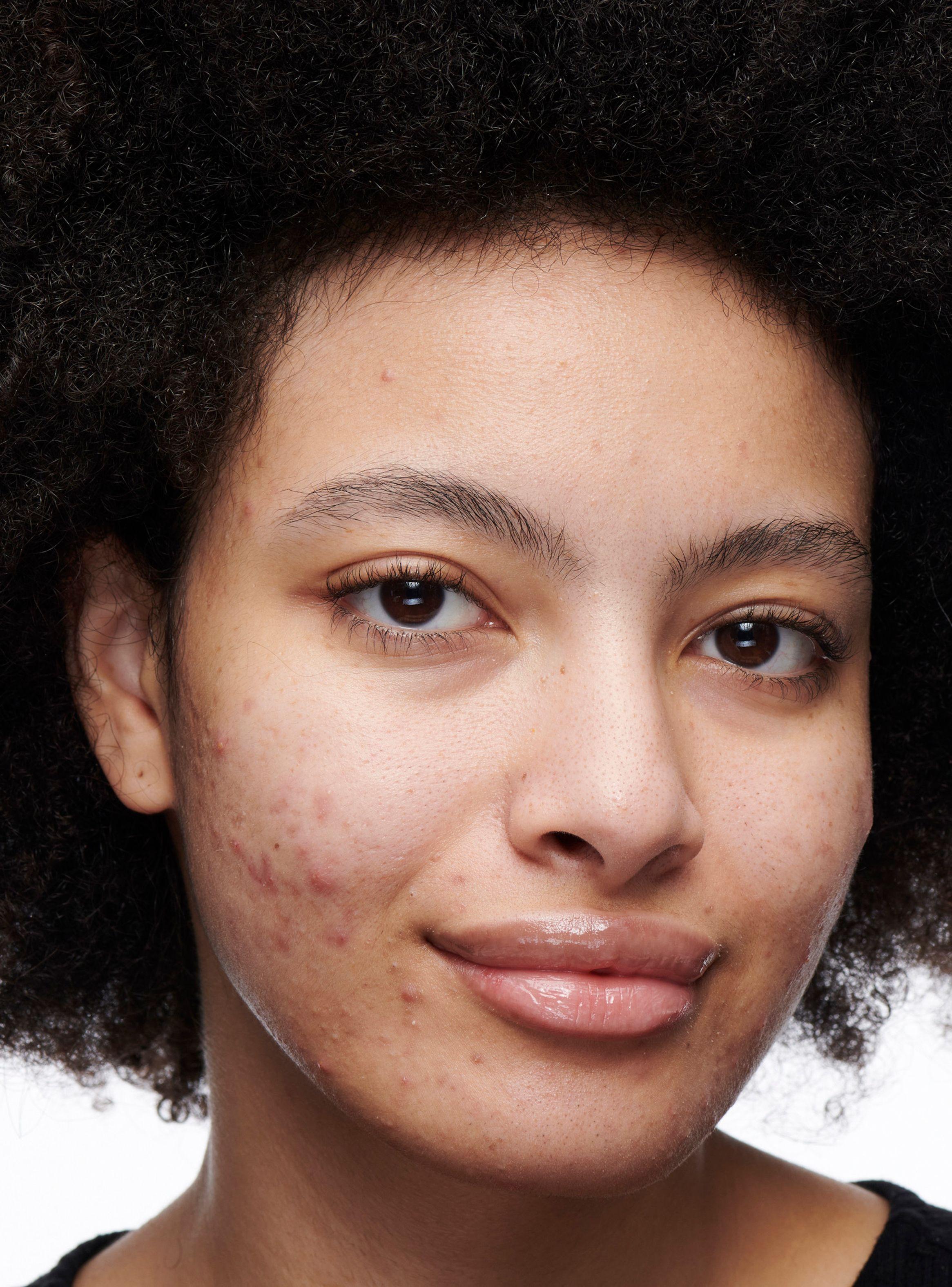 Studio Radiance Concealer NC17 11 ml-2