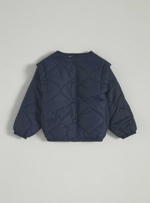 Parka Diseño Acolchado, Detalle en Hombros