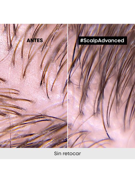Máscara 2 en 1 Limpieza Profunda Cabello Graso Scalp Advanced 250ml-5