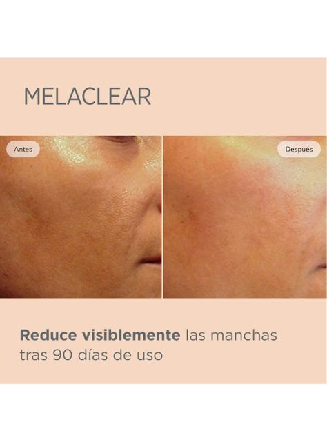 Isdinceutics Melaclear 15 ml-3