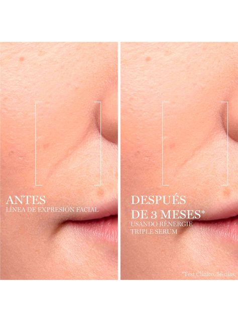 Triple Sérum Antiedad y Antiarrugas Rénergie H.C.F 50 ml-3