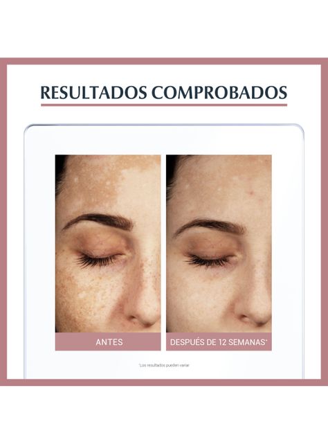 Sérum Eucerin Antipigmento Dual 30 ml-3