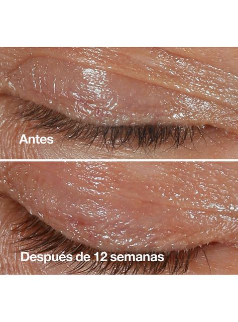 Contorno de Ojos Antiedad Clinique Smart Clinical Repair 15 ml-4