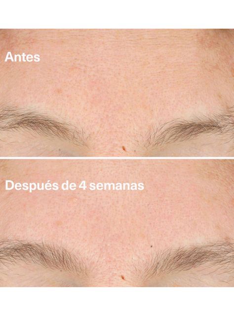 Crema Facial Clarifying Do-Over Peel-4