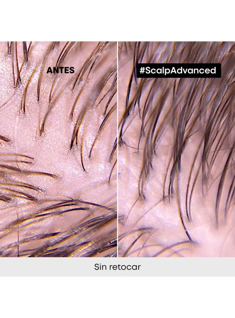 Shampoo Limpieza Profunda Cabello Graso Scalp Advanced 300ml-5