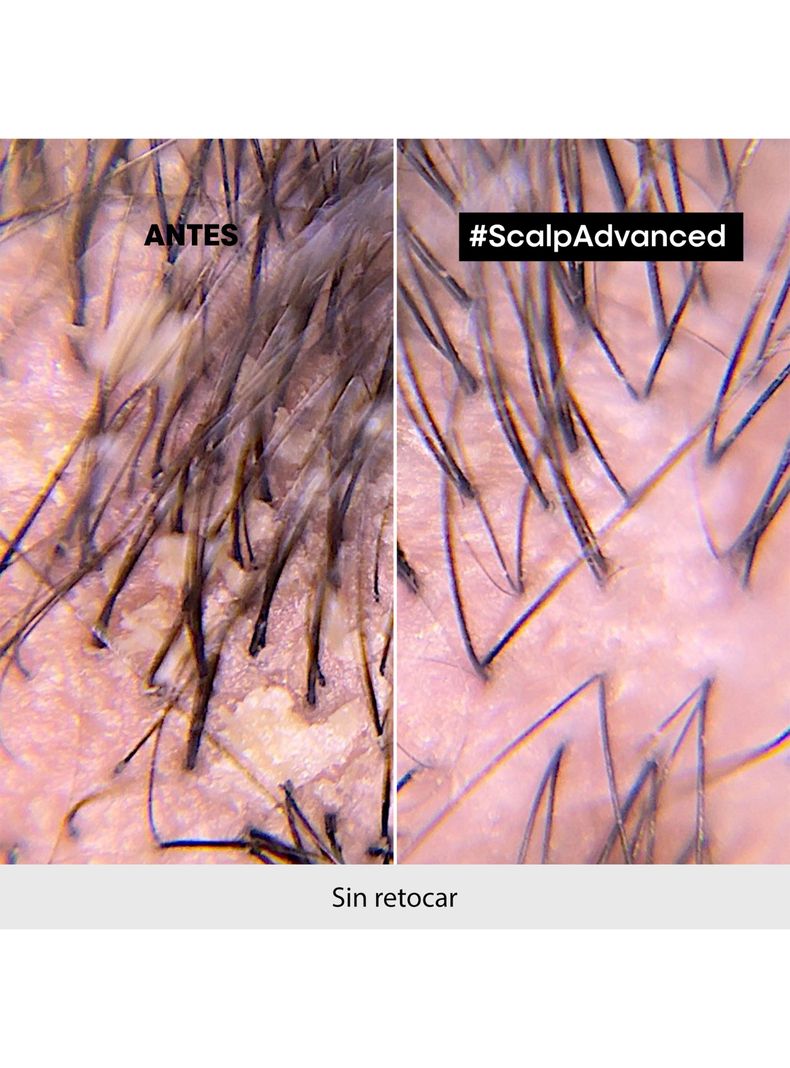 Shampoo Anti-Caspa Scalp Advanced 300ml-5