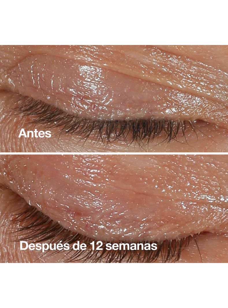 Contorno de Ojos Antiedad Clinique Smart Clinical Repair 15 ml-4
