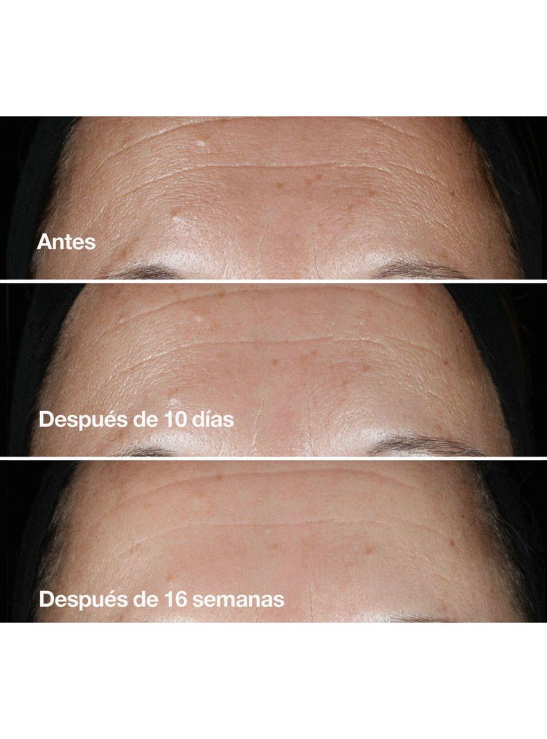 Suero Corrector de Arrugas Smart Clinical Repair 30 ml-4