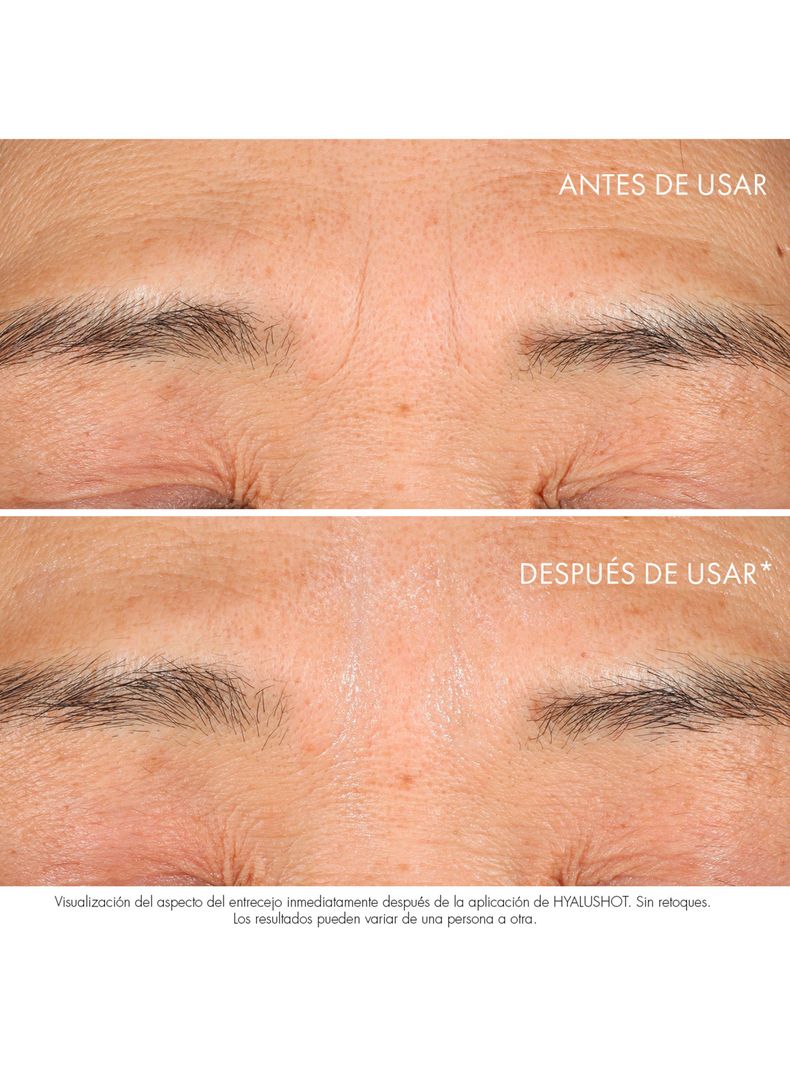 Corrector de Arrugar Dior Capture Totale Hyalushot-2