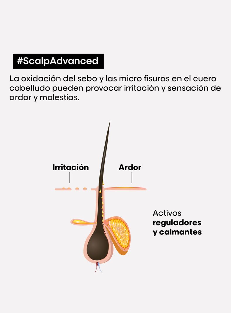 Shampoo con Niacinamida Anti-irritacion Cuero Cabelludo Irritado 500 ml L'Oréal Professionnel-2