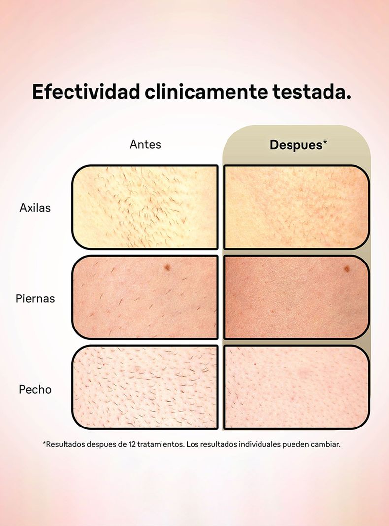 Depiladora IPL Silk-Expert Pro 5 Corporal y Facial-5