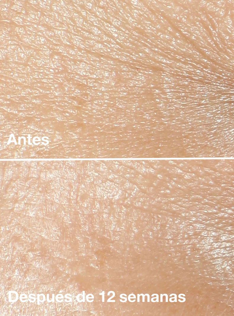 Crema Antiarrugas Smart Clinical Repair para Piel Seca-2